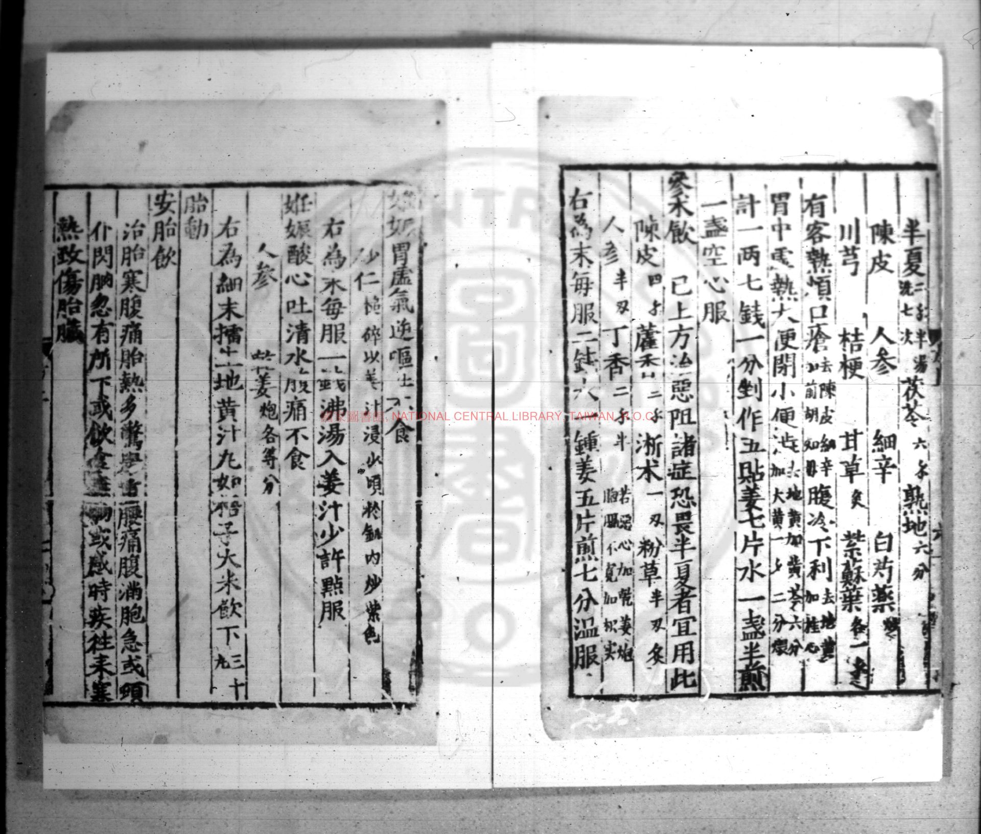 11254-胎產須知_(明)徐邦直校增_明嘉靖乙未(十四年_1535)金陵書坊趙君耀刊本1 11254-胎產須知_(明)徐邦直校增_明嘉靖乙未(十四年_1535)金陵書坊趙君耀刊本1