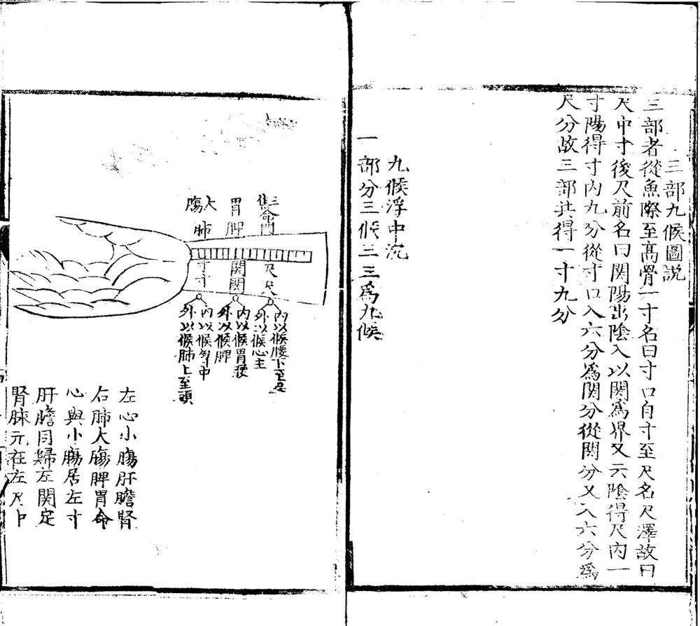 _重修脉诀指掌病式图说不分卷__ _重修脉诀指掌病式图说不分卷__