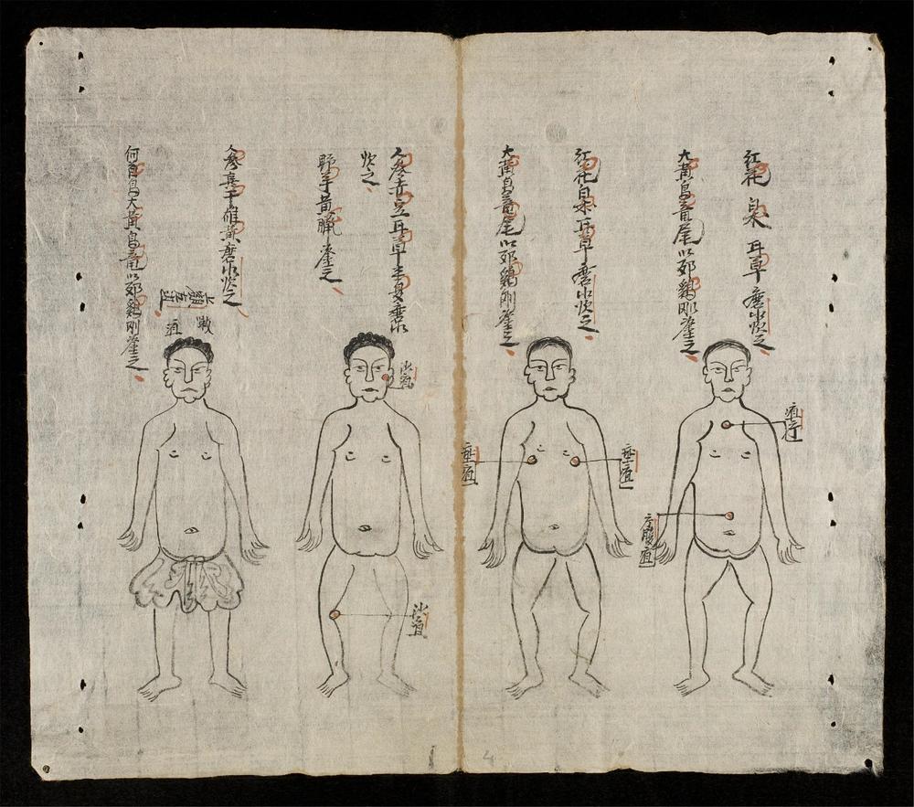 _輯驗癰疽__
