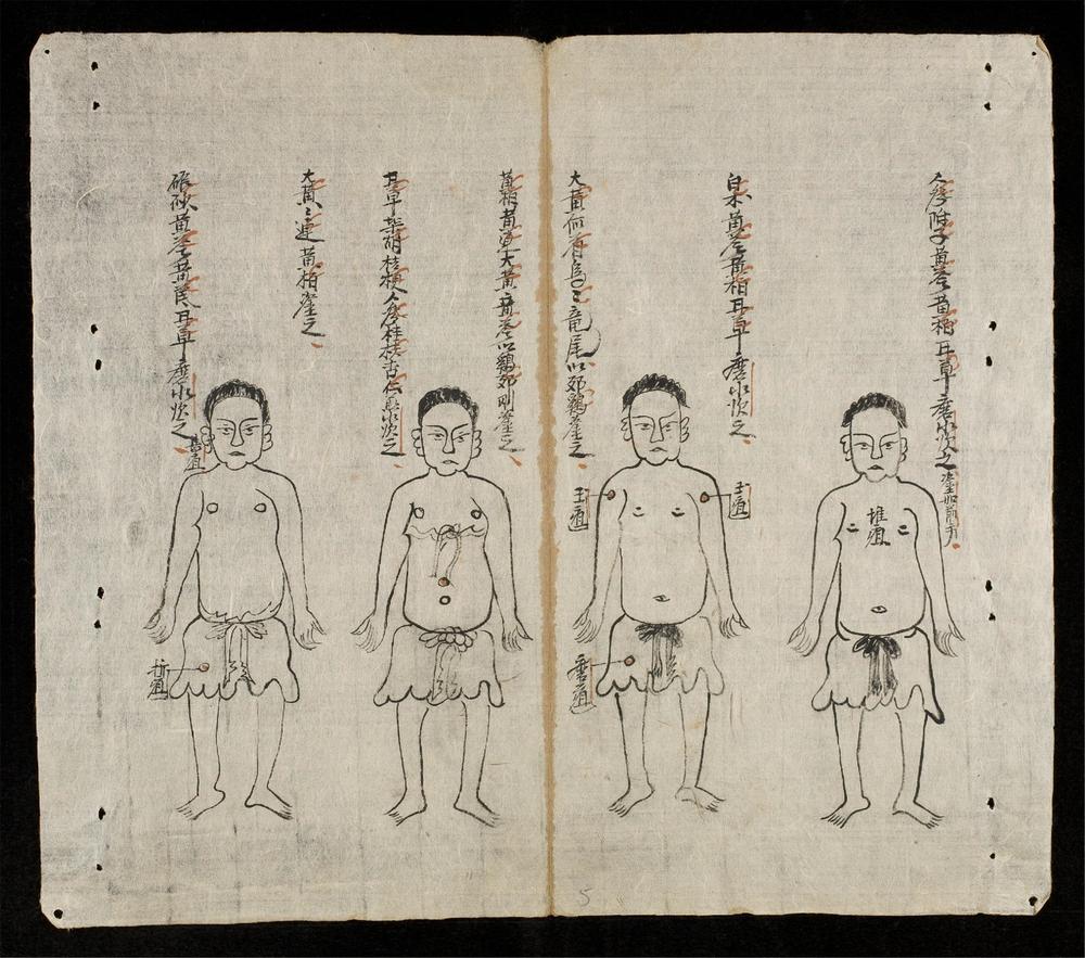 _輯驗癰疽__