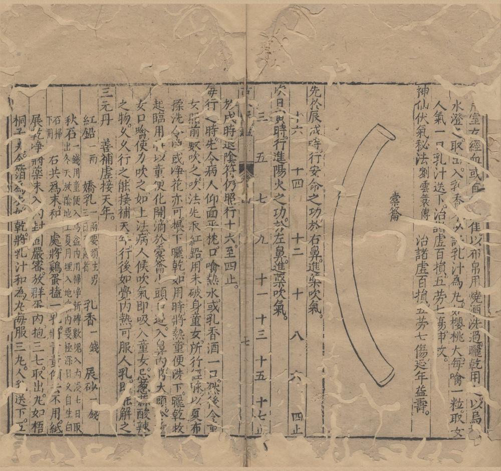 _王宇泰先生订补古今医鉴十六卷__