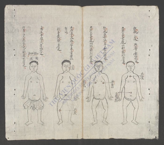 辑验痈疽-